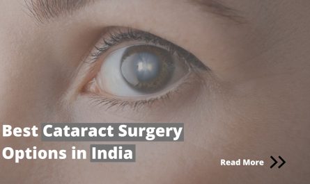 Best Cataract Surgery Options in India