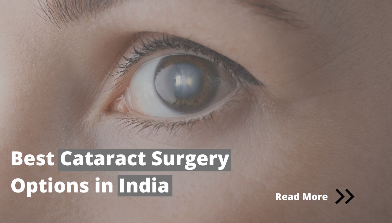 Best Cataract Surgery Options in India