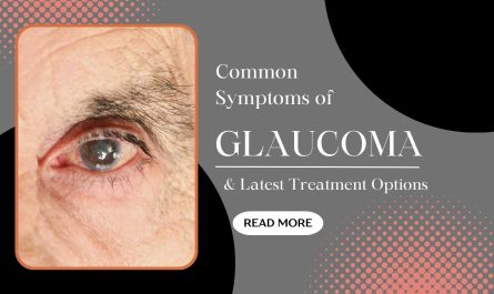 Common Symptoms of Glaucoma and the Latest Treatment Options