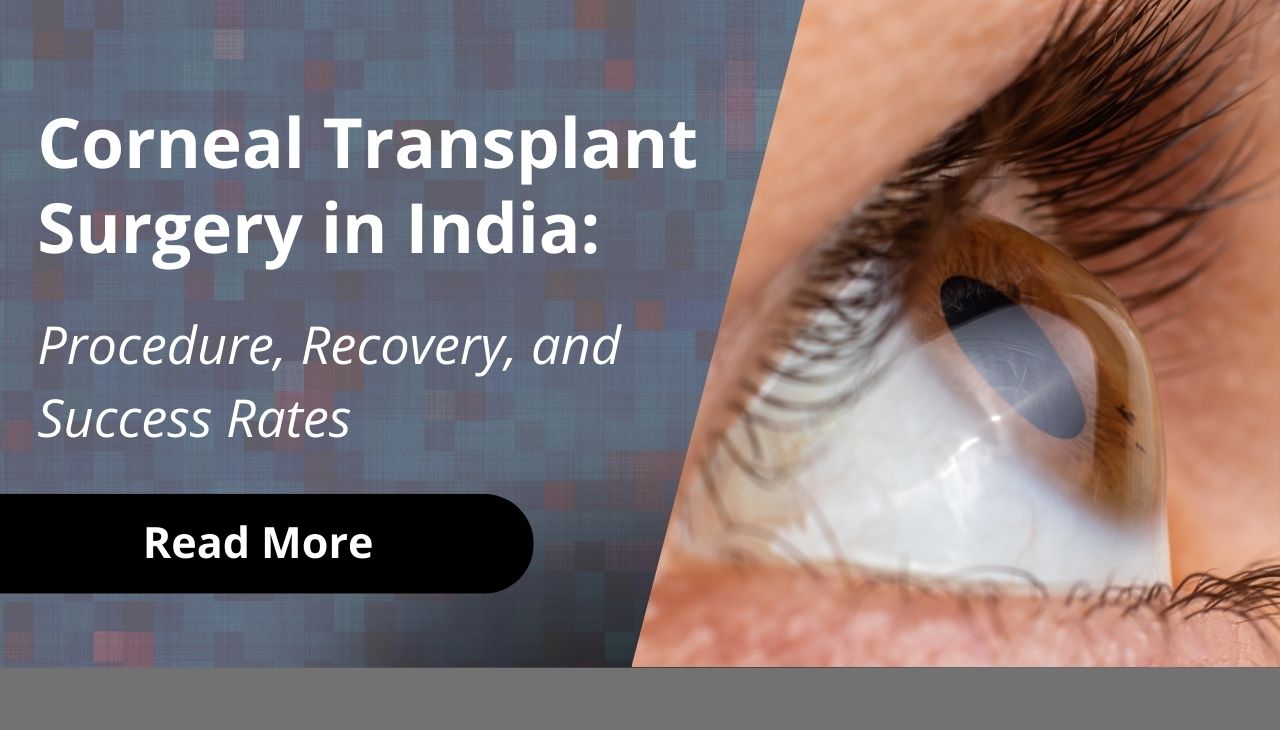 Corneal Transplant Surgery in India Procedure, Recovery, and Success Rates