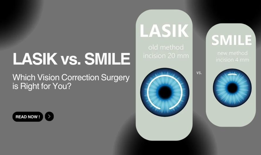 LASIK vs. SMILE: Which Vision Correction Surgery is Right for You?