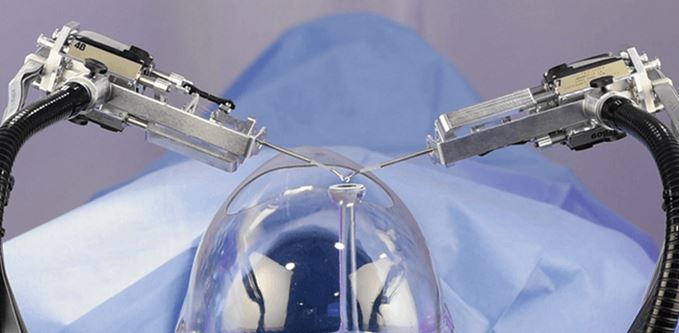 What is Robotic Laser Cataract Surgery?