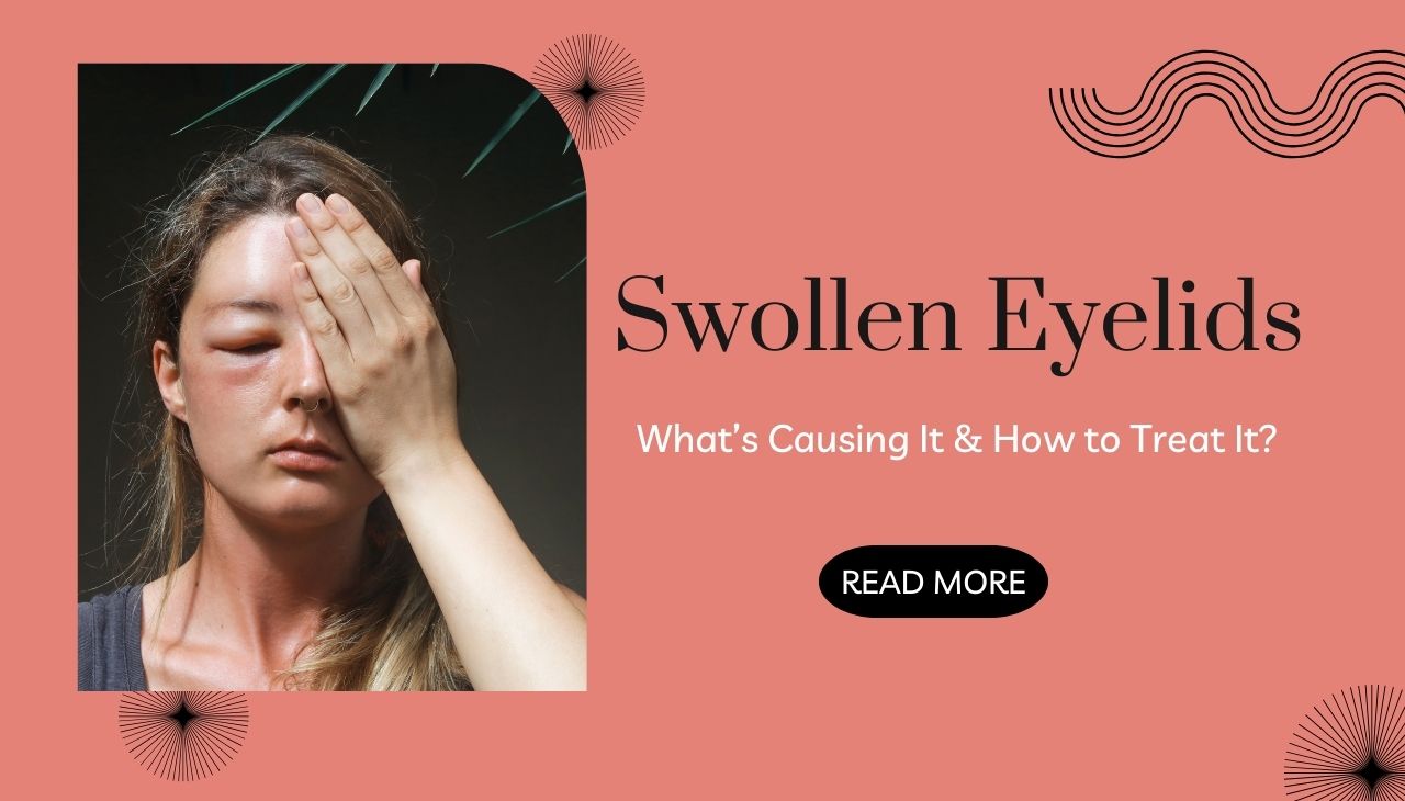 Swollen Eyelids What’s Causing It and How to Treat It