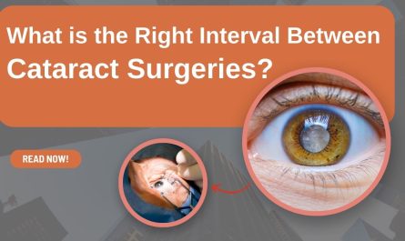 What is the Right Interval Between Cataract Surgeries?