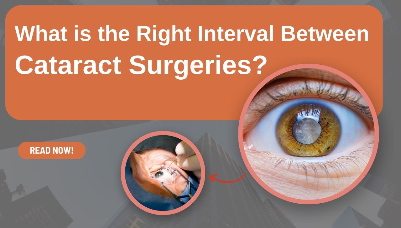 What is the Right Interval Between Cataract Surgeries?