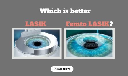 Which is better LASIK or Femto LASIK?