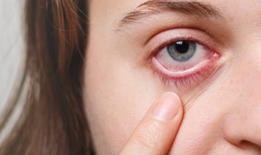 Dry Eyes: The Hidden Cause of Your Focusing Troubles!