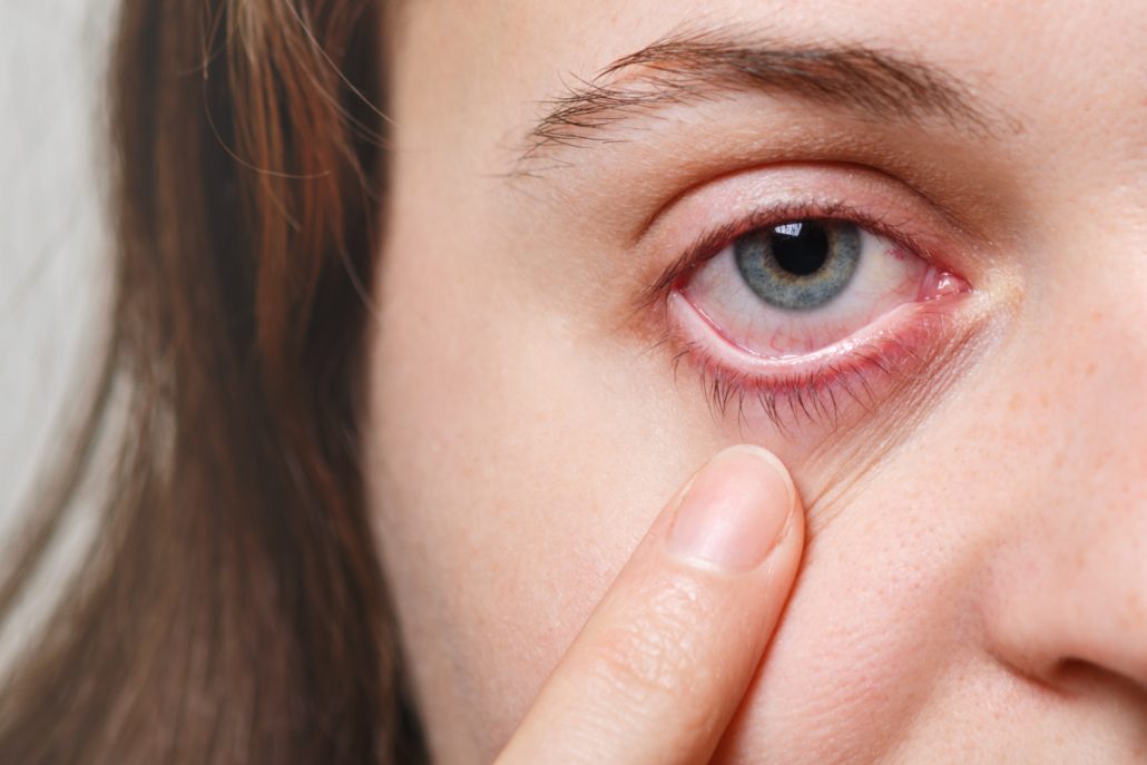 Dry Eyes: The Hidden Cause of Your Focusing Troubles!