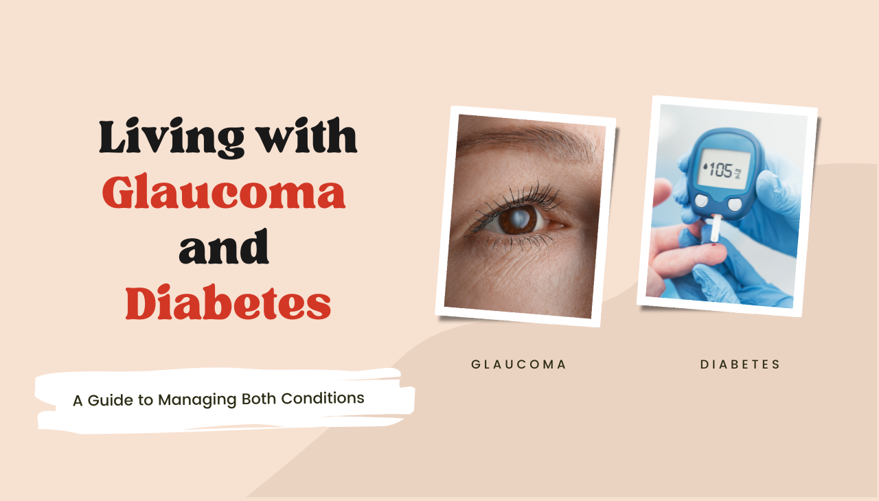 Glaucoma and Diabеtеs