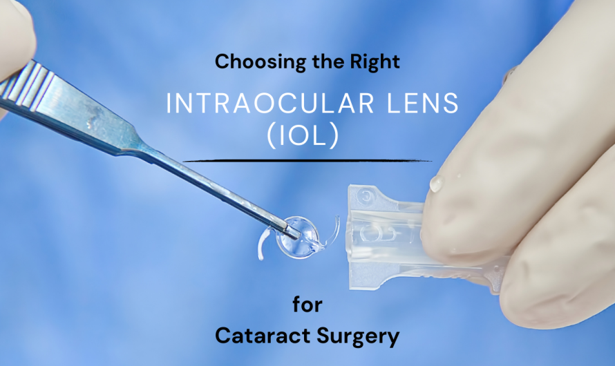 Choosing the Right Intraocular Lens (IOL) for Cataract Surgery