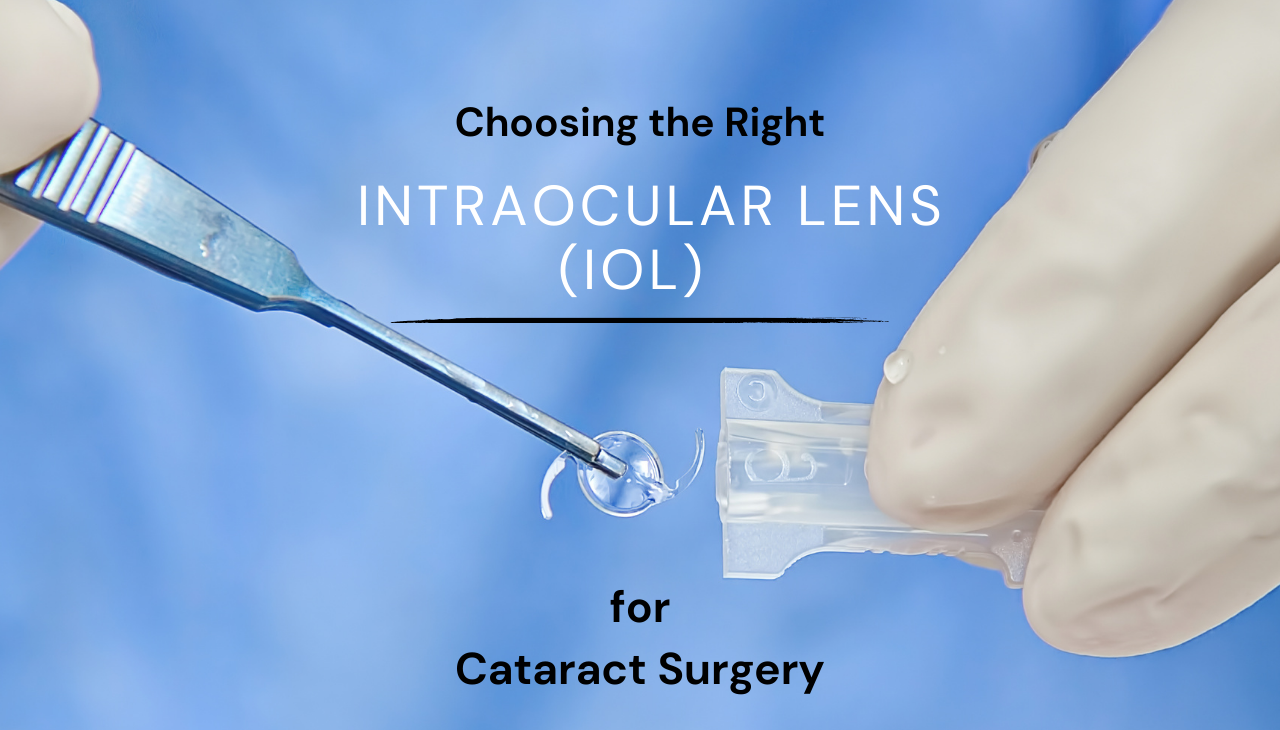 Choosing the Right Intraocular Lens (IOL) for Cataract Surgery