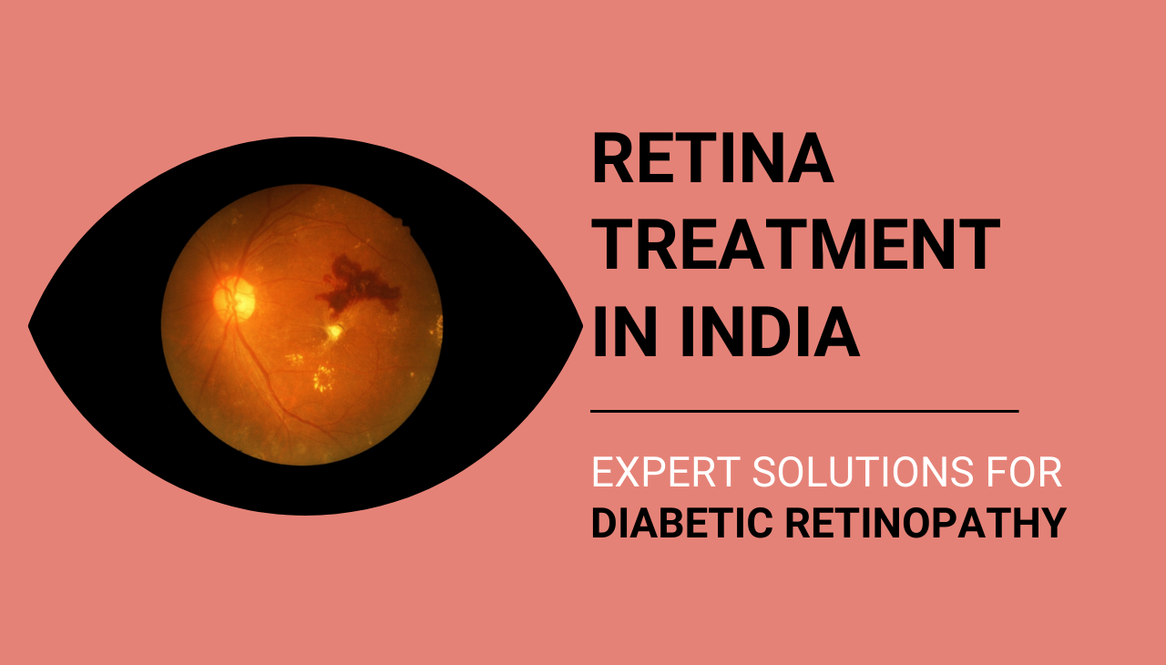 Retina Treatment in India: Expert Solutions for Diabetic Retinopathy