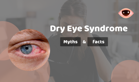 Understanding and Treating Dry Eye Syndrome - Myths and Facts