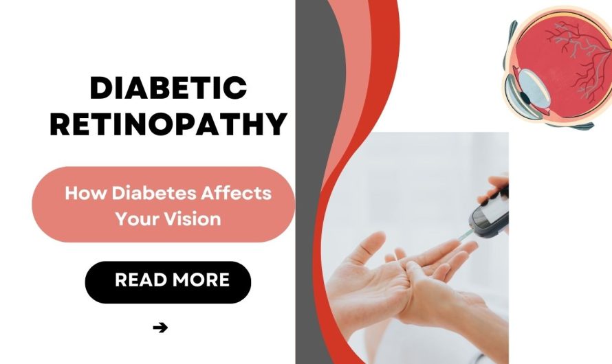 Diabetic Retinopathy: How Diabetes Affects Your Vision