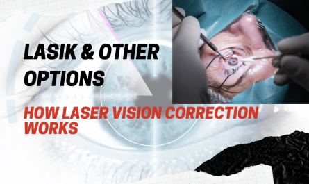 How Laser Vision Correction Works: LASIK & Other Options