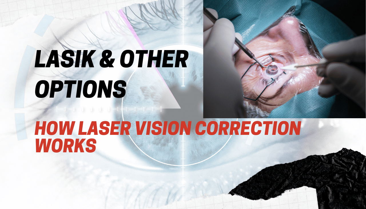 How Laser Vision Correction Works: LASIK & Other Options