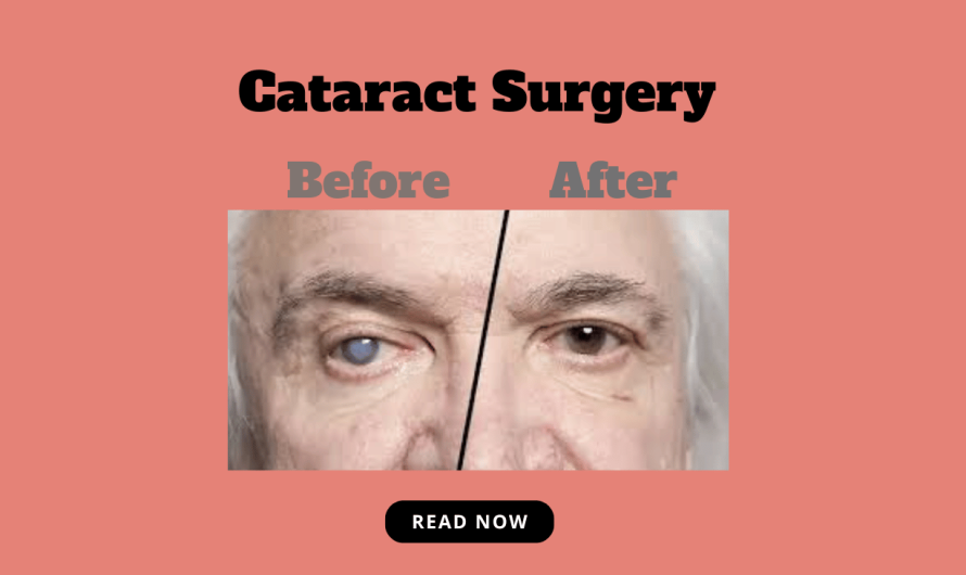 Understanding Cataracts and Cataract Surgery Archives - Laxmi Eye Hospital