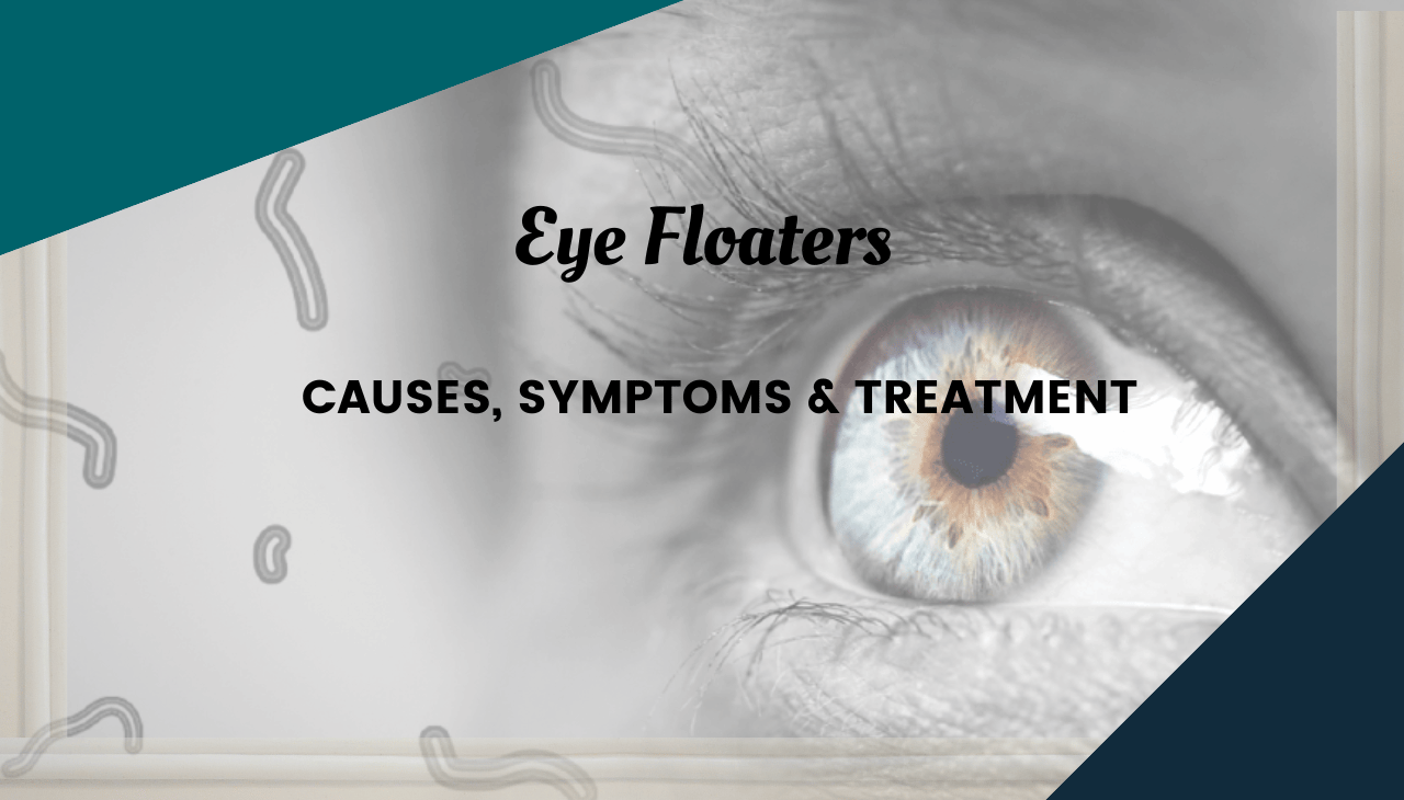 Eye Floaters: Causes, Symptoms & Treatment