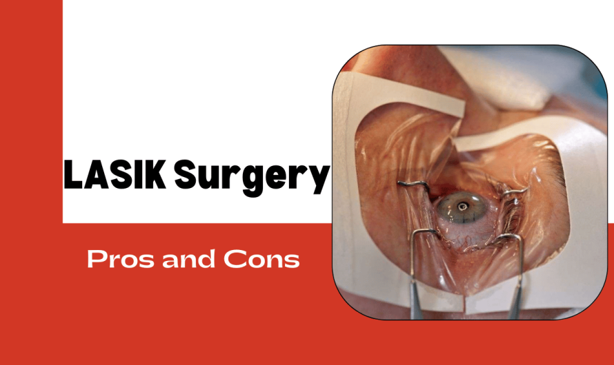 LASIK Surgery: Weighing the Pros and Cons