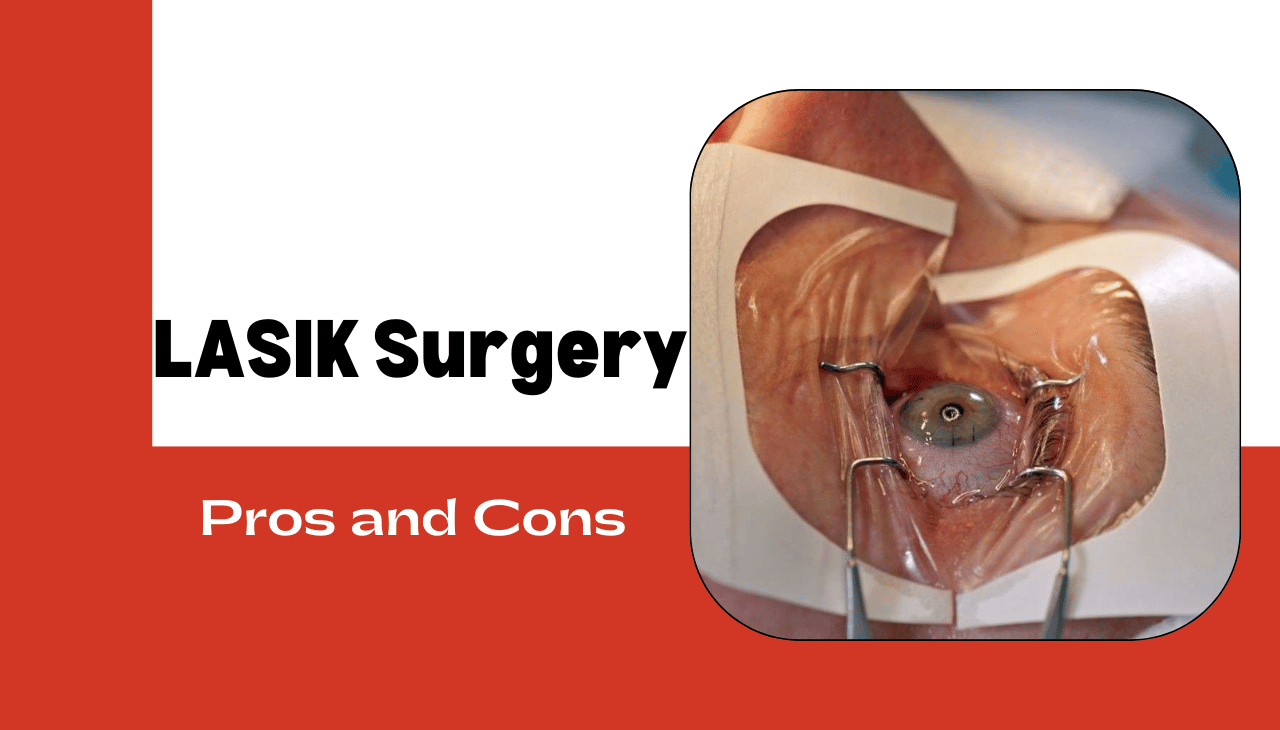 LASIK Surgery: Weighing the Pros and Cons