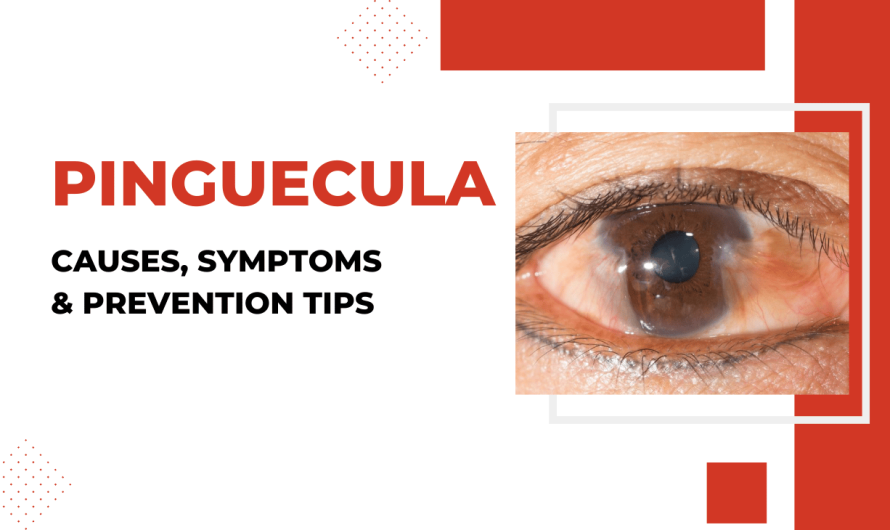 Pinguecula: Causes, Symptoms & Prevention Tips