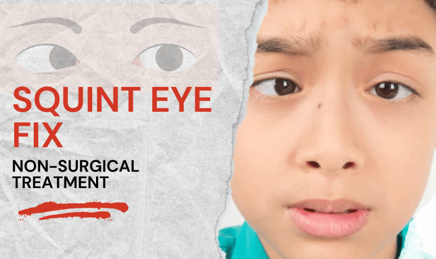 Squint Eye Fix: Non-Surgical Treatment Options