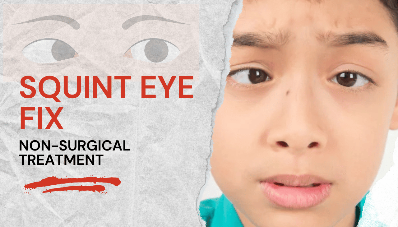 Squint Eye Fix: Non-Surgical Treatment Options