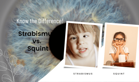 Strabismus vs. Squint: What Sets Them Apart?