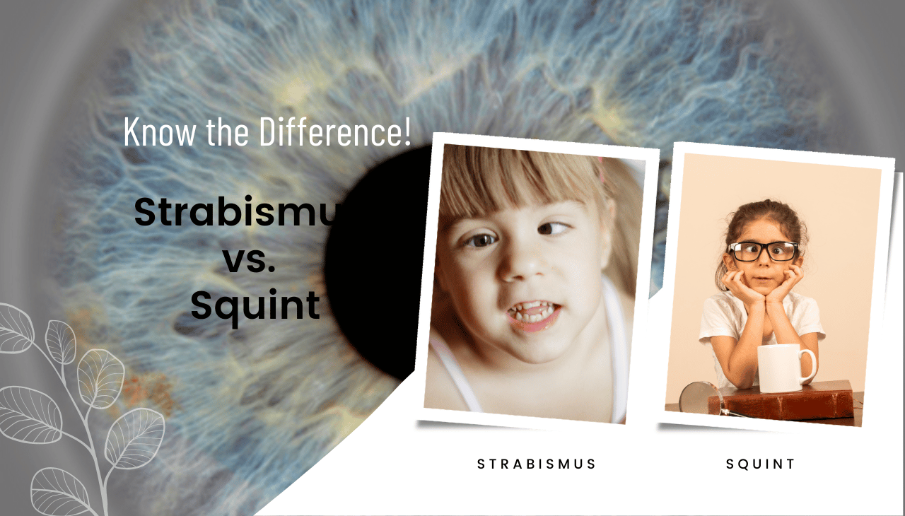 Strabismus vs. Squint: What Sets Them Apart?